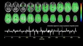 Transient brain activity disentangles fMRI resting-state dynamics in terms of spatially...