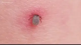 It's tick season! How you can avoid the pesky bugs