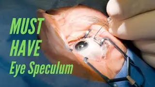 Must Have Eye Speculums for Ophthalmology