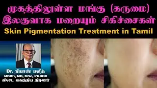 மங்கு மறைய இலகுவான சிகிச்சைகள் | Skin Pigmentation Treatment in Tamil | Hyperpigmentation