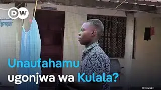 Ufahamu ugonjwa unaosababisha kulala kupita kiasi.