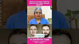 Solution for those with patchy beard | How to get a full beard? #ytshorts #beard #beardstyle #hai...