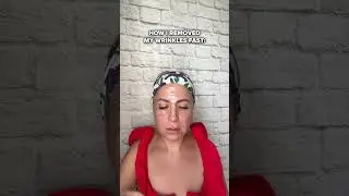 How I removed my wrinkles fast with SoSmooth Anti-Wrinkle Patches! 🌟
