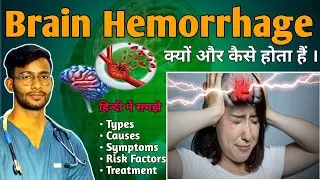 🧠 Brain Hemorrhage क्यो और कैसे होता हैं | Types | Causes, Symptoms, Risk Factors and Treatment