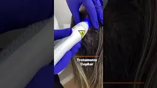 5 indica&ccedil;&otilde;es para Laser Pulse!!