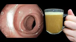 Natural Colon Cleanse: best natural colon cleanse Try colon cleanse at home