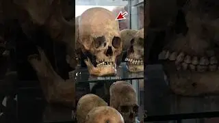 Strange Ancient Skulls of Peru