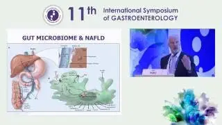 Current approaches to diagnosis and treatment of NAFLD
