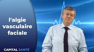 l'algie vasculaire faciale - Capital Santé