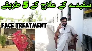 Safaida ka ilaj | Aseel Face Treatment | سفیدے کا علاج | Fahad Amir