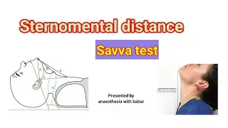 Sternomental distance | SAVVA TEST | SHORT VIDEO @anaesthesiawithbabar2576
