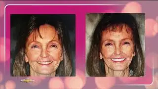 Smile Transformation - The Art of Dentistry - Dr. Robin Rutherford on Studio 7