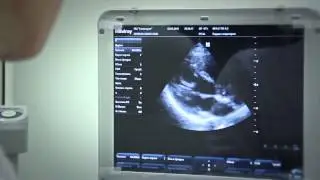 Центр цифровой УЗИ диагностики в Нягани