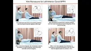 Kim Manoeuvre for Left Anterior Canal BPPV