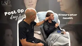 Bay Area Brow Lift & Deep Plane Facelift: Dr. Lieberman Explains Recovery 15 Hours Post-Surgery