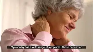 Myelopathy
