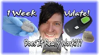 Inspire sleep apnea ( Does It Really Work? )