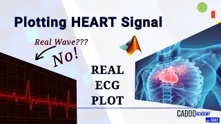 Plotting Real-time ECG Signal in MATLAB | CADDD Academy
