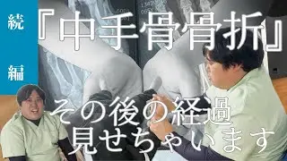 【どこまで回復した！？】中手骨骨折の施術動画公開❣️