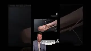 Dr. Porter Explains Aaron Rodgers' Achilles Surgery