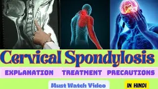 Cervical Pain Kya Hota Hai !! Cervical Spondylosis Exercises !! Dr Rajesh Sharma PT