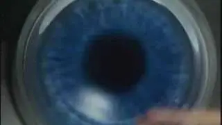 LasikPlus Intralase&reg; Bladeless LASIK Procedure: All-Laser Lasik