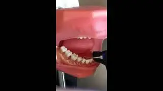 Professor Norrell: Use of Sickle Scaler 204S