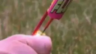 How to Treat a Fireworks Burn