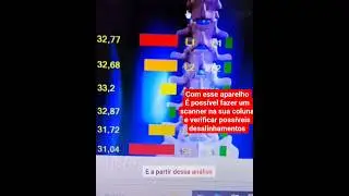 Explicando como funciona a avalia&ccedil;&atilde;o da coluna vertebral com a utiliza&ccedil;&atilde;o do aparelho Thermo scan