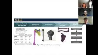 Parametric Modeling of the Upper Extremities &mdash; 2023 UMTRI Student Poster Competition