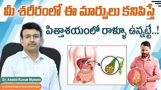 Gallbladder Stone Causes and Treatment || Gallbladder Stone Symptoms in Telugu || Renova Hospitals