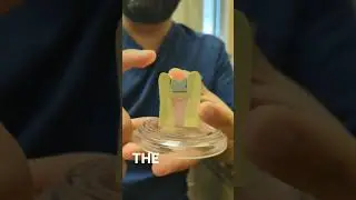 Understanding and Preventing Cracked Teeth in the Dental Community