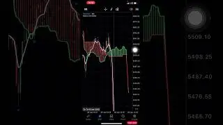Best XAUUSD Strategy Ever 🤑