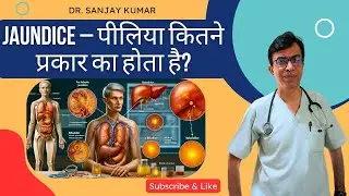 Types Of Jaundice &ndash; पीलिया कितने प्रकार का होता है? | कौन सा पीलिया सबसे ज्यादा खतरनाक होता है?