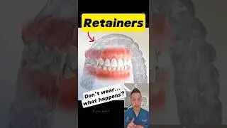 The Truth About Retainers: Why You Should Never Skip Them! #dentallan #dentist #shorts