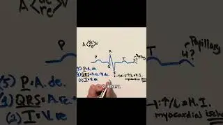 EKG (ECG) Intervals Made Easy: ST, PR, and QT (Mnemonics Inside) #ekg #ecg #electrophysiology