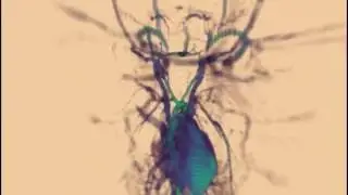 Mouse Embryo Vasculature Abstractions - MRI
