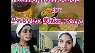 Home remedies for uneven skin tone/How to alleviate Hyper Pigmentation |GeetaKAgarwal
