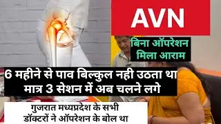No Hip Replacement! AVN का सफल इलाज सिर्फ 3 सेशन में | Gujarat से आये मरीज चलने लगे Dr Bharat Sharma