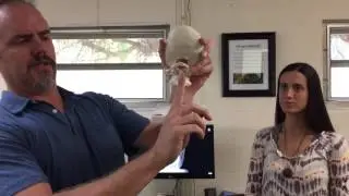 Ojai, CA Chiropractor discusses possible causes and solutions to Trigeminal Neuralgia