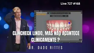 Live 727 #168. &ldquo;Meu caso ficou lindo no ClinCheck, mas n&atilde;o se traduz na boca. O que eu errei?&rdquo; 📱