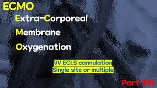 EXTRACORPOREAL MEMBRANE OXYGENATION(ECMO), VV-ECLS Cannulation-Two site, or Multiple