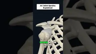 Shoulder Injury Explained: AC Joint Sprain Anatomy & Forces #shorts