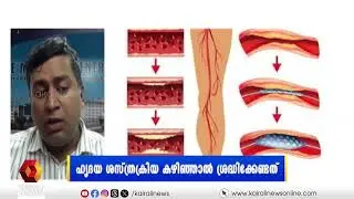 ഹൃദയ ശസ്ത്രക്രിയ കഴിഞ്ഞാൽ പൊതുവേ ശ്രദ്ധിക്കേണ്ട കാര്യങ്ങൾ എന്തെല്ലാം? | HELLO DOCTOR