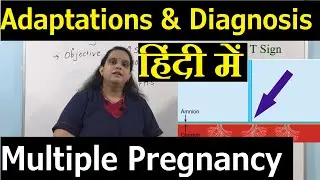 Multiple Pregnancy Maternal Adaptations & Diagnosis in Hindi | Nursing Lecture