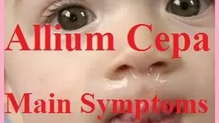 Allium Cepa | All-c | Cepa Vulgaris: Homeopathic Medicine Main Symptoms &ndash;Easy Tips For Practitioners