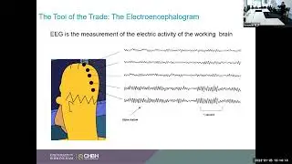 Utility of brain rhythm in gauging individual's pain sensitivity & acute low-grade inflammation