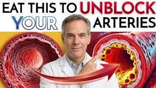 Top 10 Artery-Cleansing Foods You Must Eat Before It&rsquo;s Too Late