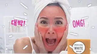 Kim Chiu Says OMG to Dry and Red Skin (Seoul White Korea)