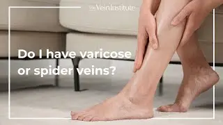 Is it Varicose Veins or Spider Veins?